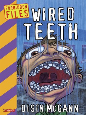 cover image of Wired Teeth